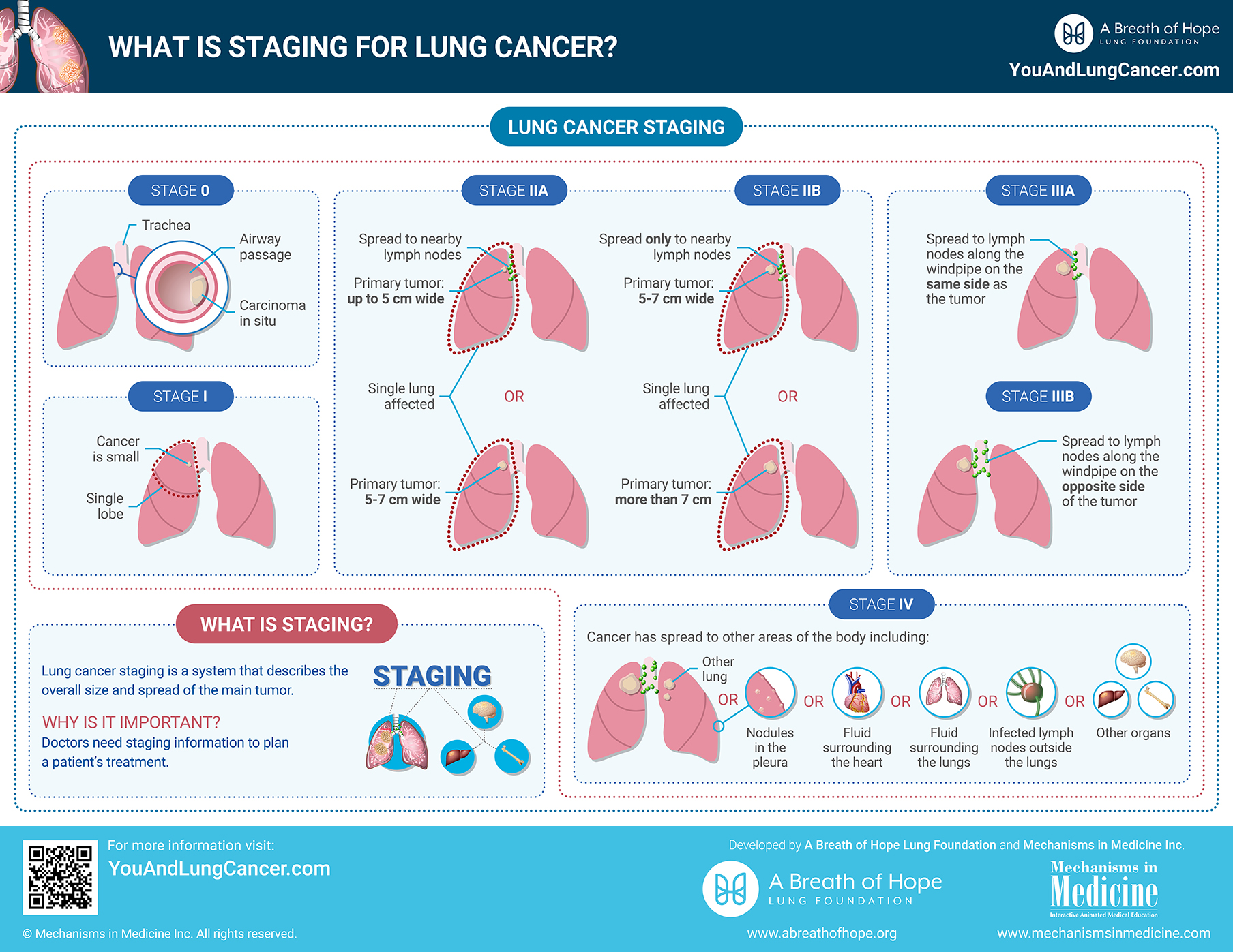 What Is Staging For Lung Cancer