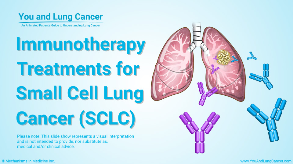 Slide Show Immunotherapy Treatments for Small Cell Lung