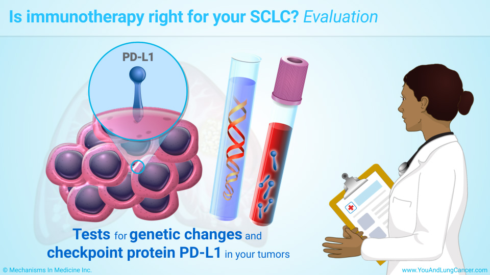 Slide Show Immunotherapy Treatments for Small Cell Lung