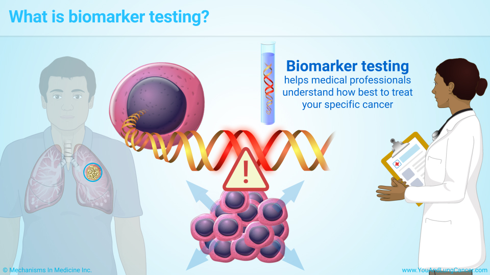 Slide Show - Understanding Biomarker Testing In Non-Small Cell Lung Cancer