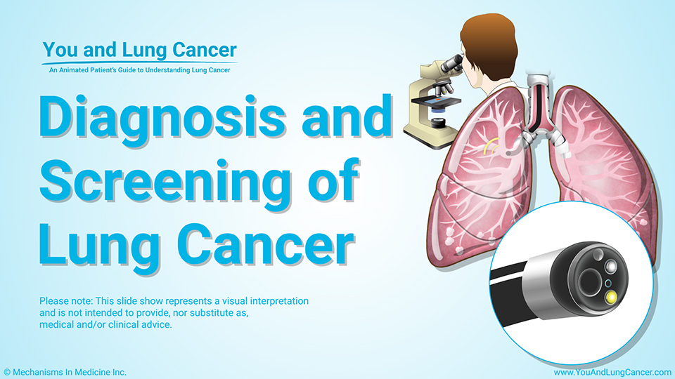 what-is-a-lung-biopsy