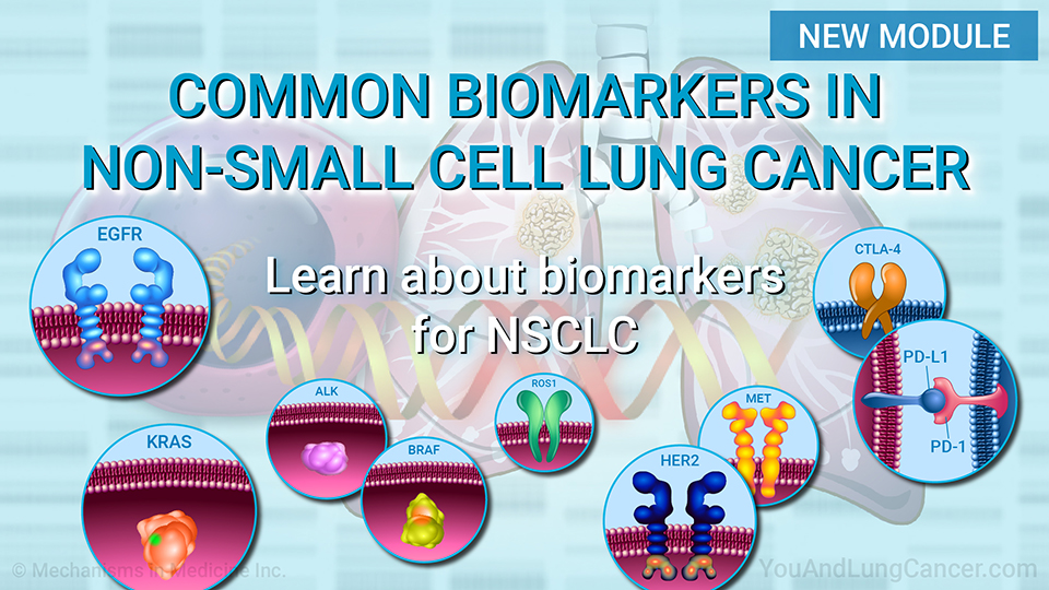Common Biomarkers in Non-Small Cell Lung Cancer. Learn about biomarkers for NSCLC.