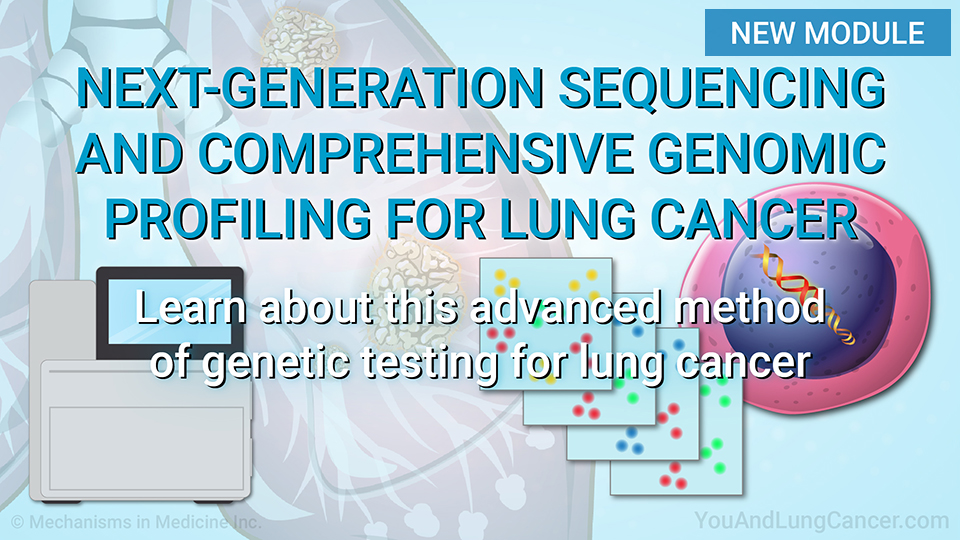 Understanding Prehabilitation in Lung Cancer Surgery.