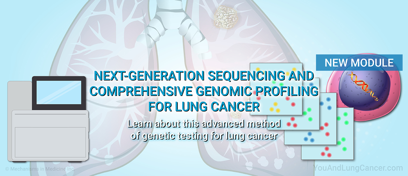 Understanding Prehabilitation for Lung Cancer Surgery.