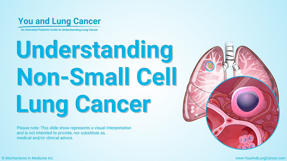 Animation Understanding NonSmall Cell Lung Cancer