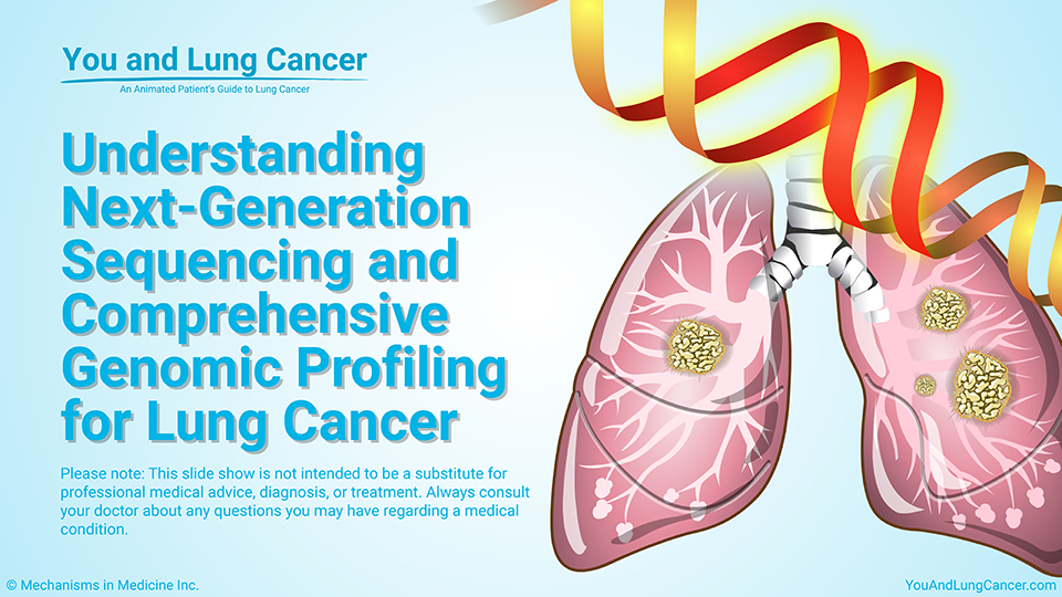 Slide Show - Understanding Next-Generation Sequencing and Comprehensive Genomic Profiling for Lung Cancer