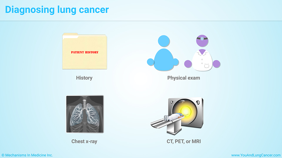 Slide Show - Diagnosis and Screening of Lung Cancer