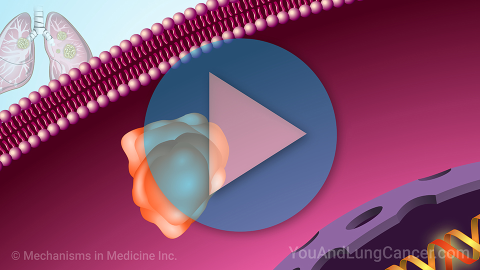 Animation - Understanding NSCLC Treatment Options When You Have a KRAS Mutation