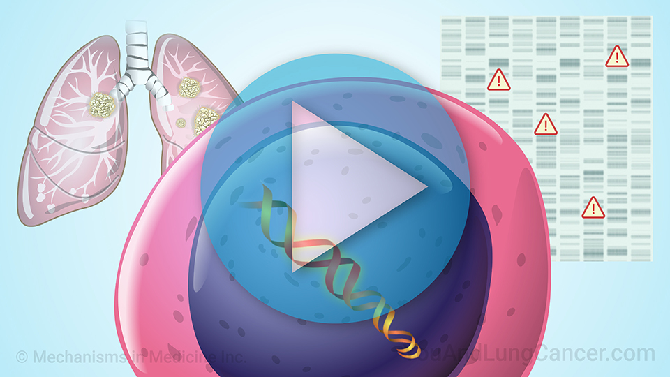 Animation - Understanding NSCLC Treatment for Less Common Mutations: ALK, BRAF, ROS1, HER2, MET