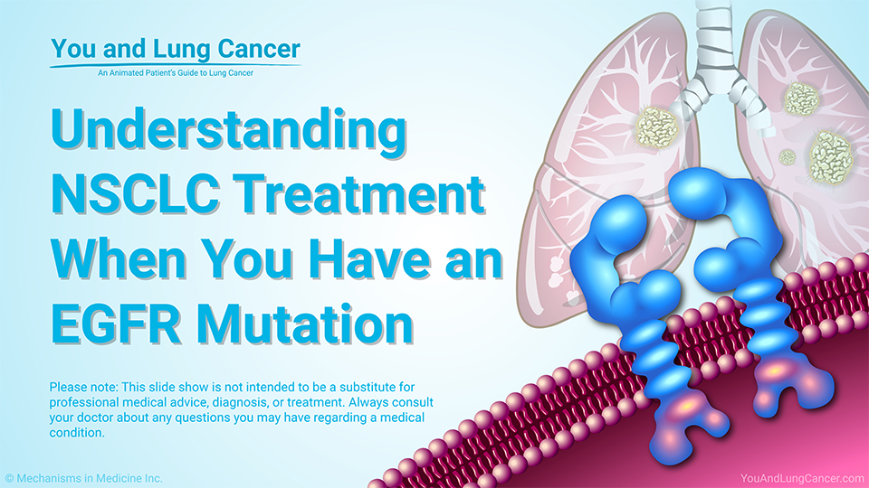 Slide Show - Understanding NSCLC Treatment When You Have an EGFR Mutation