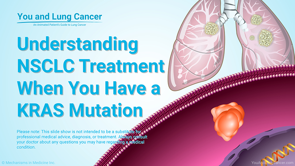 Slide Show - Understanding NSCLC Treatment Options When You Have a KRAS Mutation