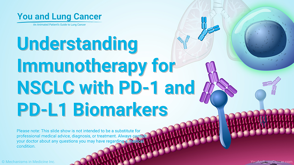 Slide Show - Understanding Immunotherapy for NSCLC with PD-1 and PD-L1 Biomarkers