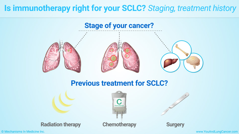 Slide Show - Immunotherapy Treatments for Small Cell Lung Cancer (SCLC)