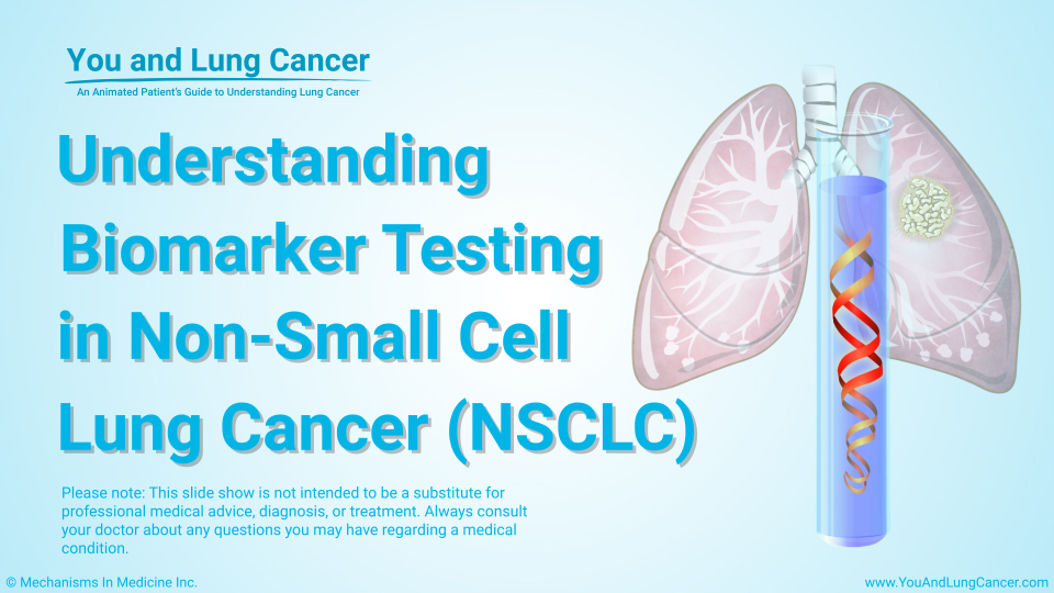 Slide Show - Understanding Biomarker Testing in Non-Small Cell Lung Cancer