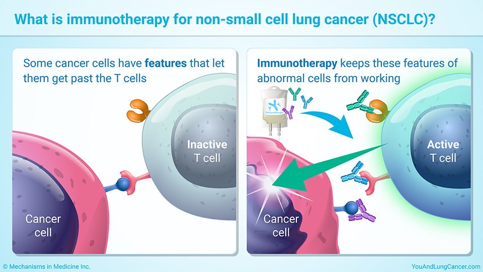 What is immunotherapy for NSCLC?