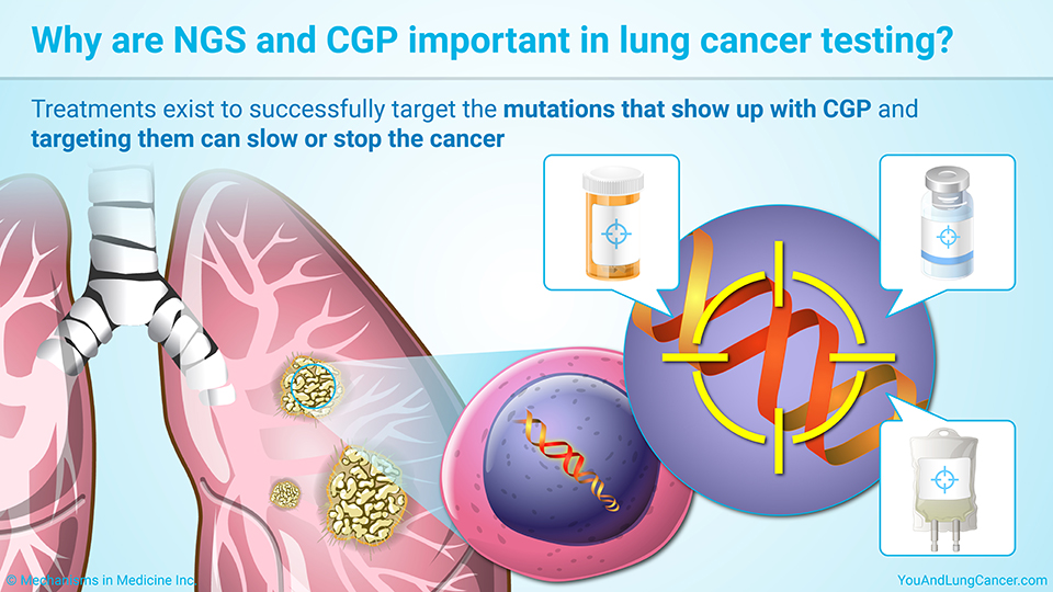 Why are NGS and CGP important in lung cancer testing?