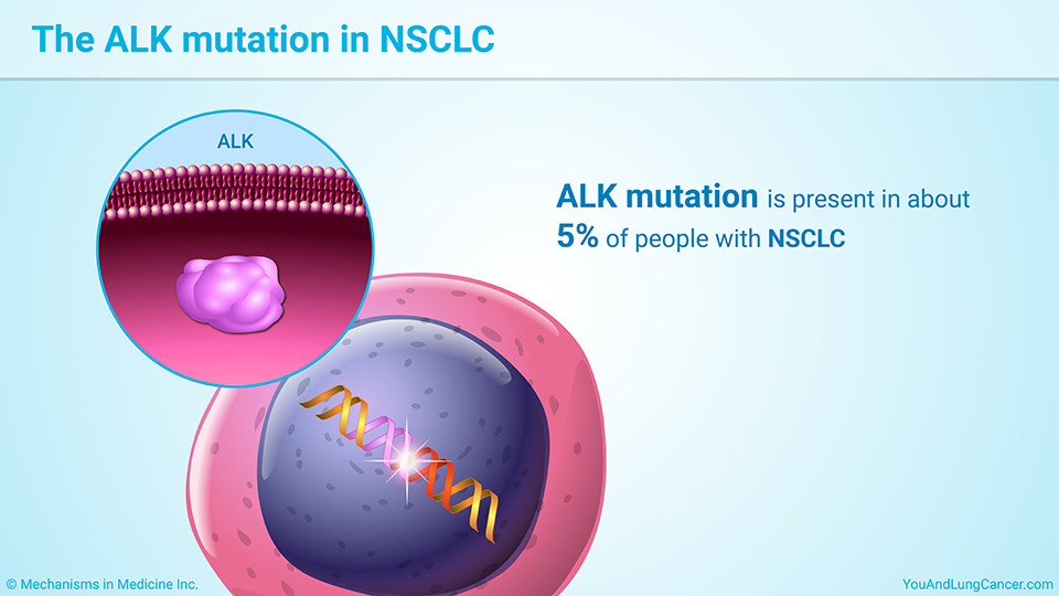 The ALK mutation in NSCLC