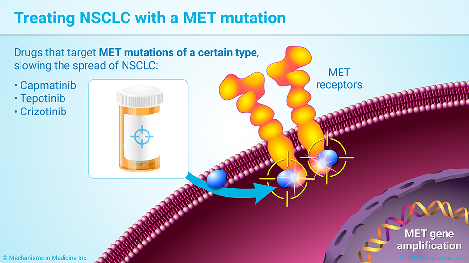 Treating NSCLC with a MET mutation