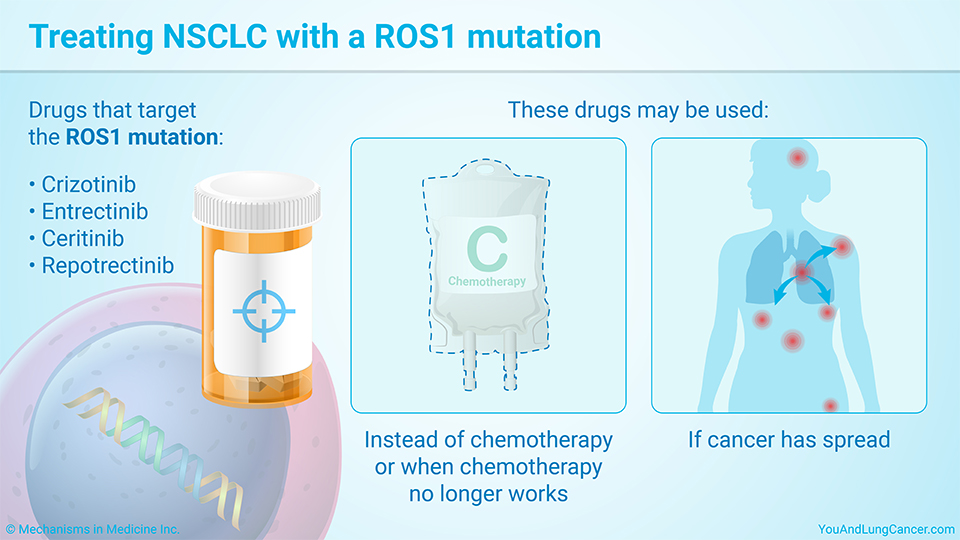 Treating NSCLC with a ROS1 mutation