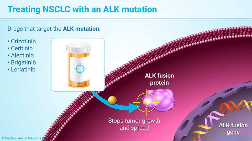 Treating NSCLC with an ALK mutation