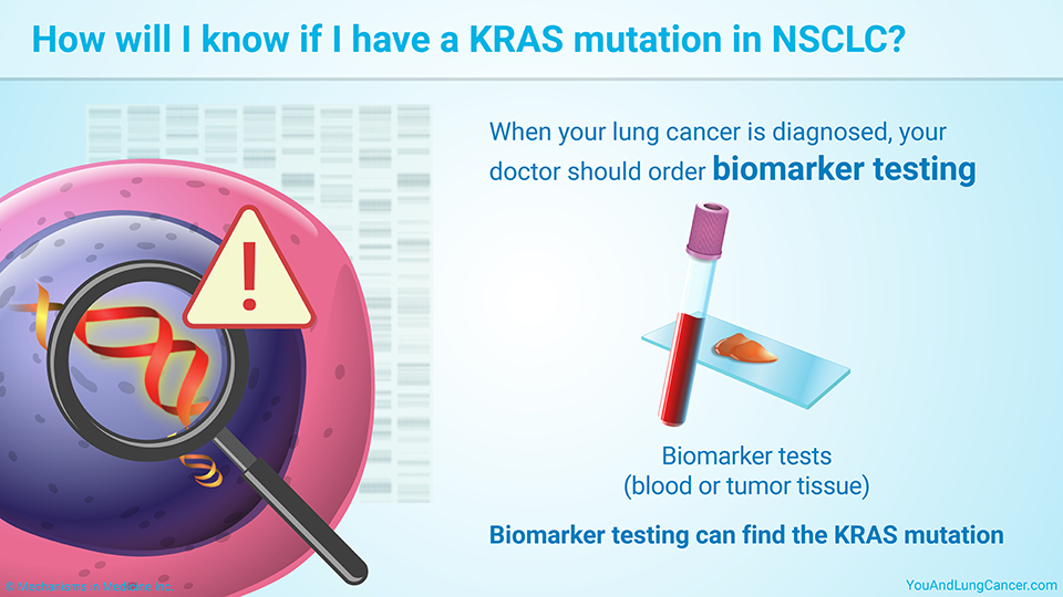 How will I know if I have a KRAS mutation in NSCLC?