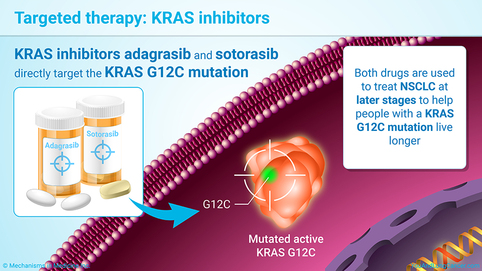 Targeted therapy: KRAS inhibitors