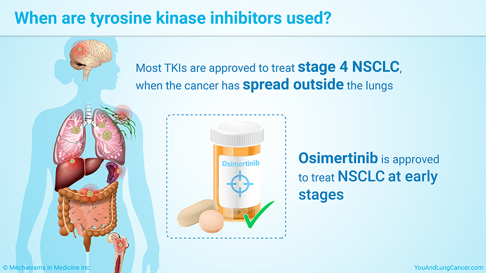 When are tyrosine kinase inhibitors used?