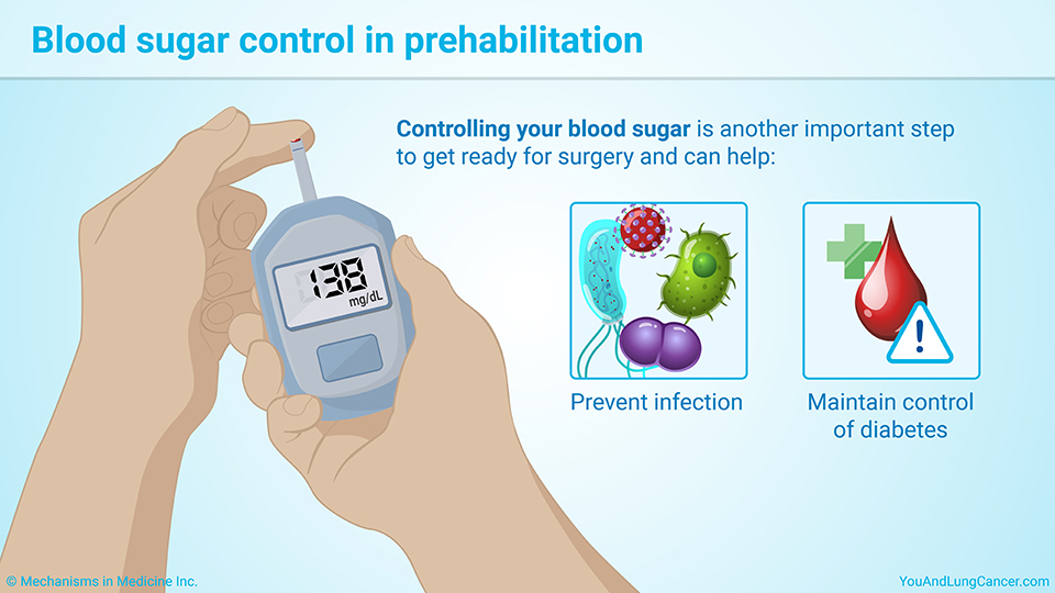 Blood sugar control in prehabilitation