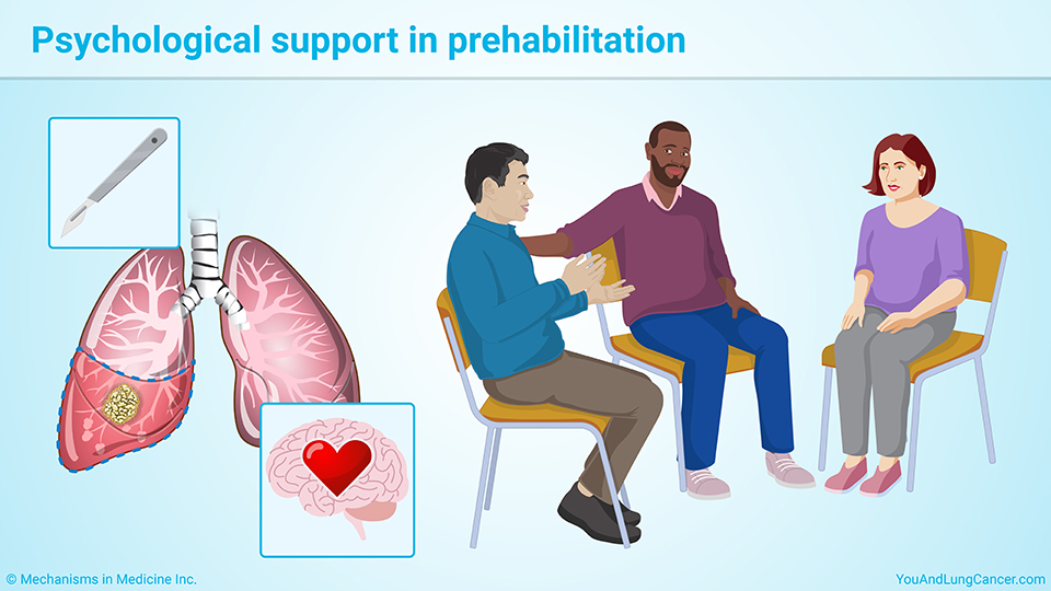 Psychological support in prehabilitation