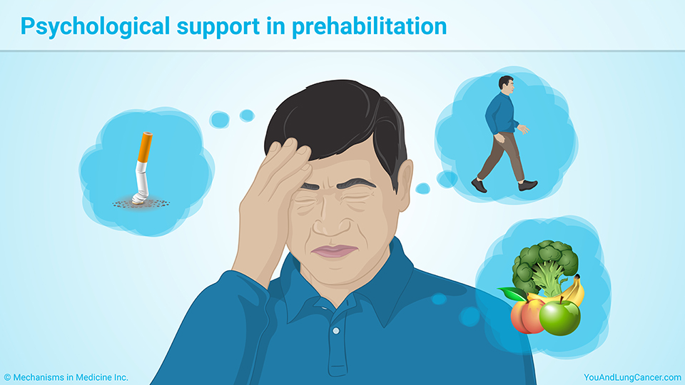 Psychological support in prehabilitation