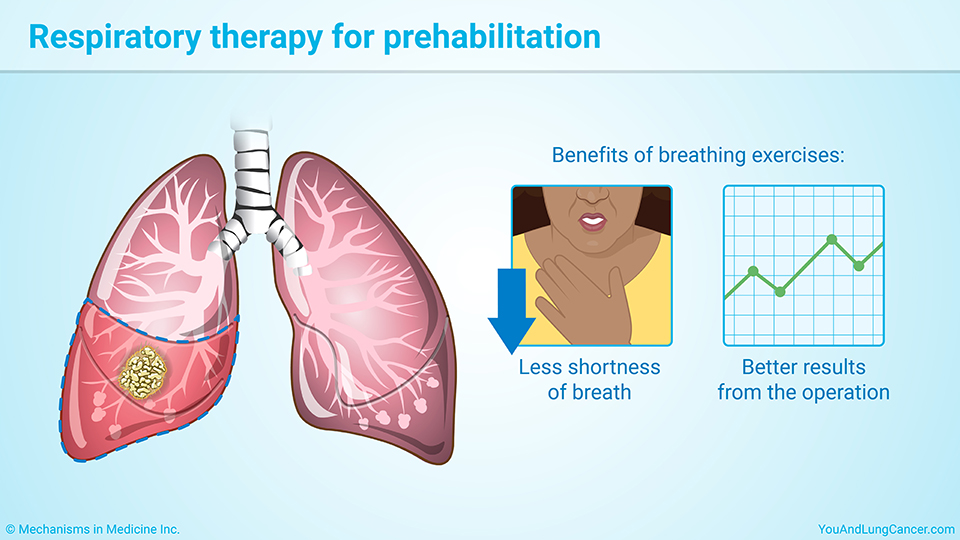 Respiratory therapy for prehabilitation