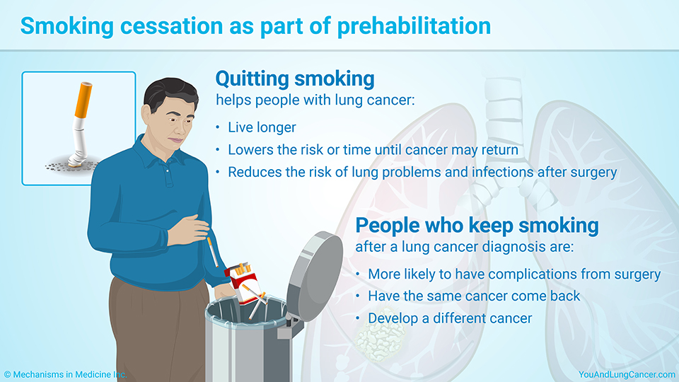 Smoking cessation as part of prehabilitation