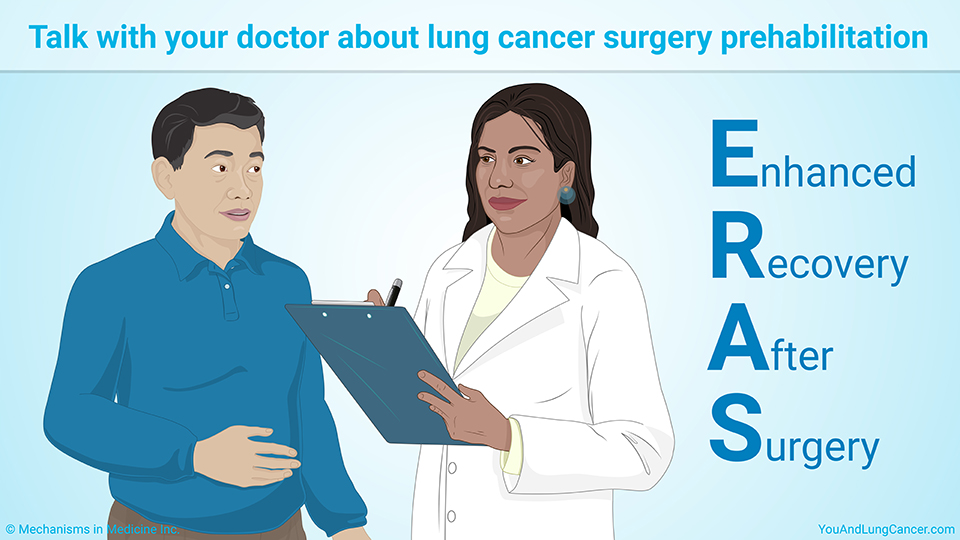 Talk with your doctor about lung cancer surgery prehabilitation