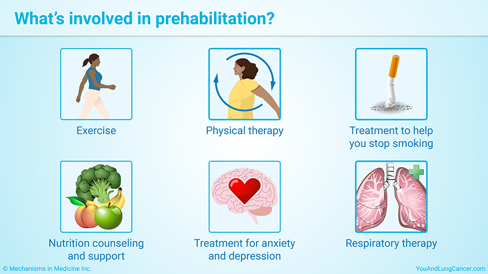 What’s involved in prehabilitation?