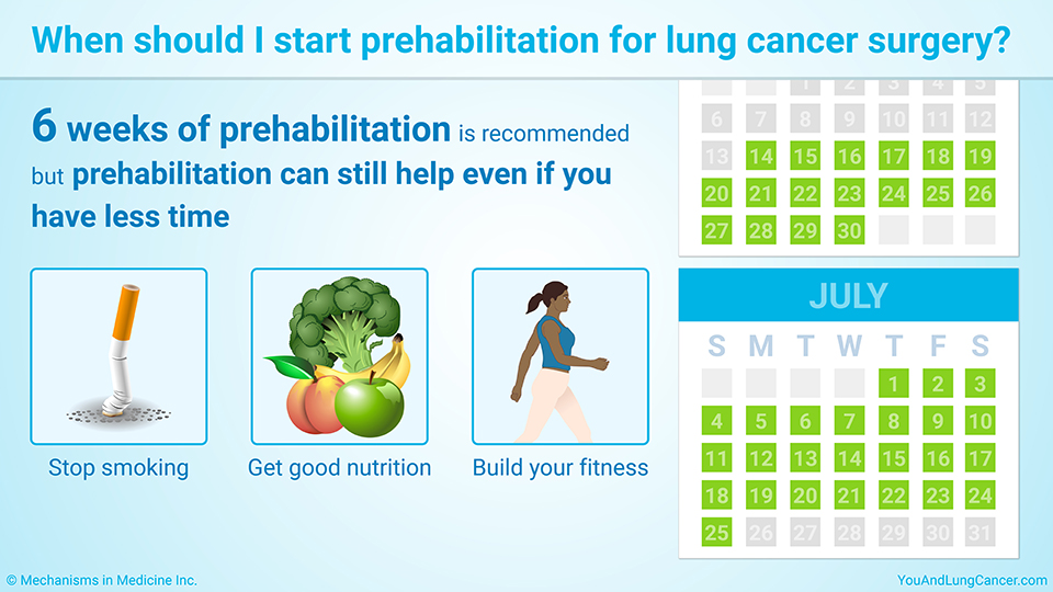 When should I start prehabilitation for lung cancer surgery?