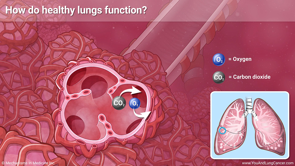 Small cell lung cancer stories