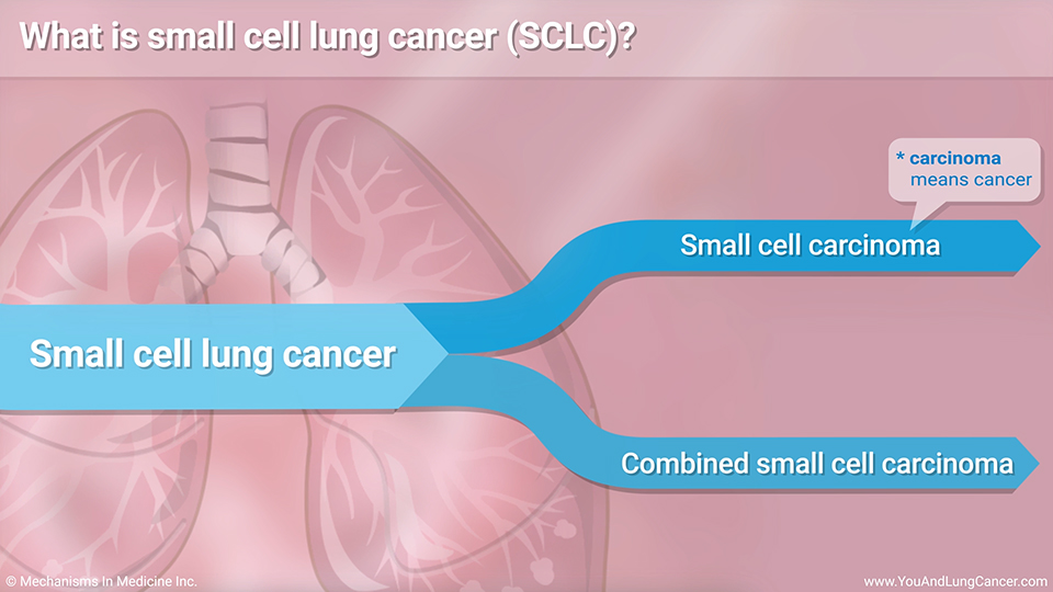 Slide Show Understanding Small Cell Lung Cancer