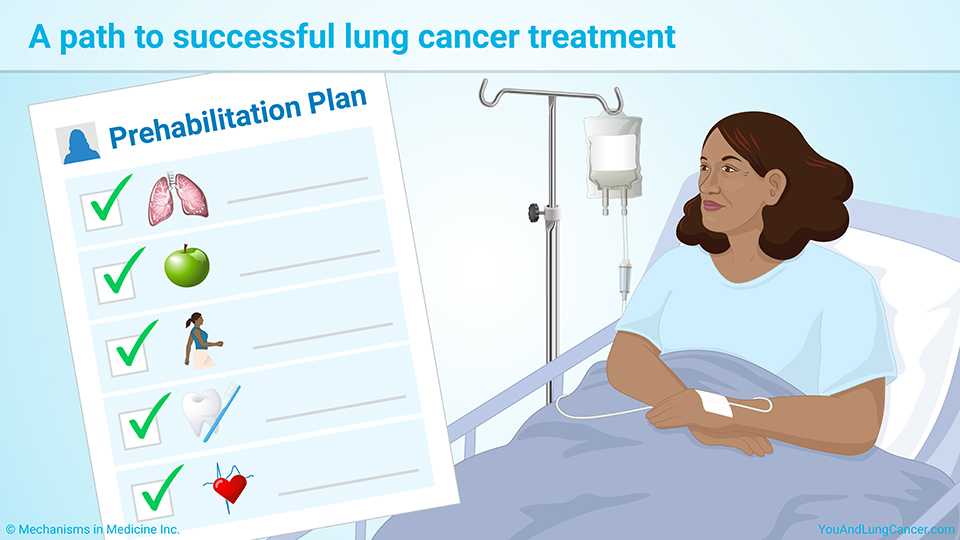 A path to successful lung cancer treatment