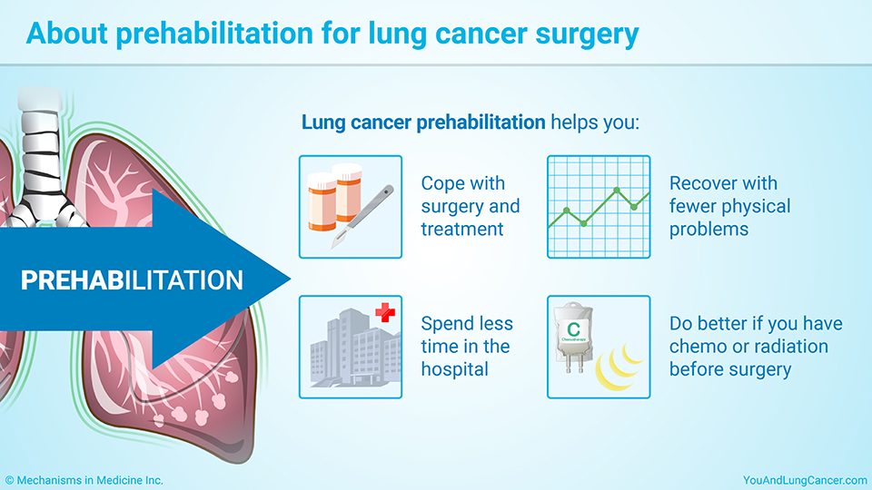 About prehabilitation for lung cancer surgery