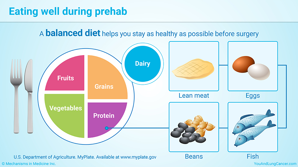 Eating well during prehab