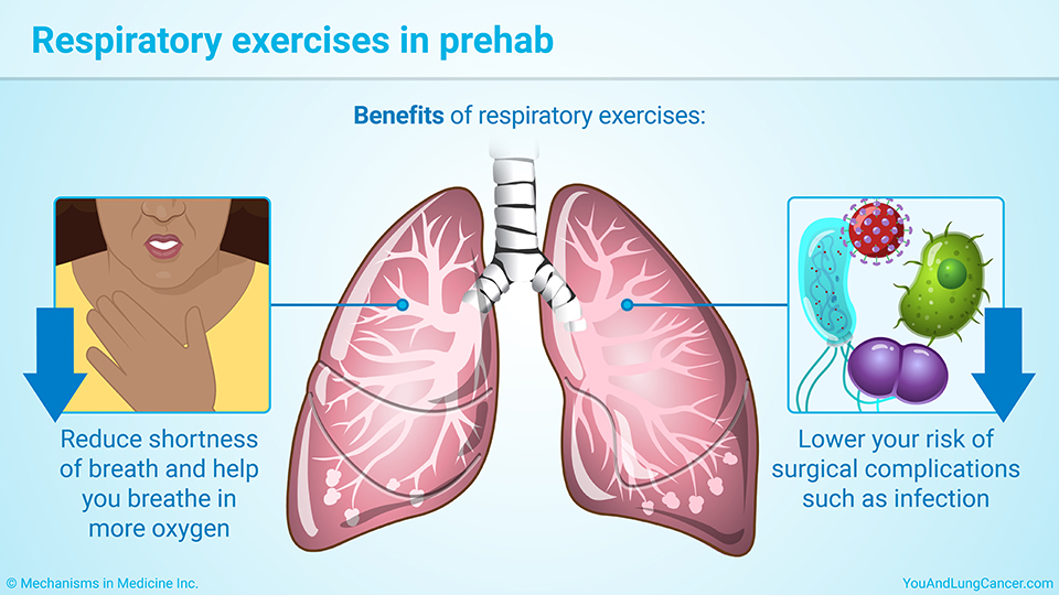 Respiratory exercises in prehab