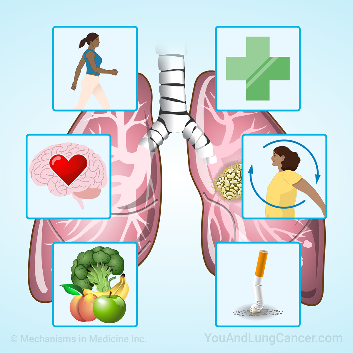 Understanding Prehabilitation for Lung Cancer Surgery